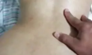 ગુદા પ્રોલેપ્સમાં પત ...