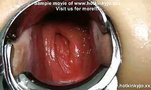 તેમના ગર્દભ માં ગુદા ...